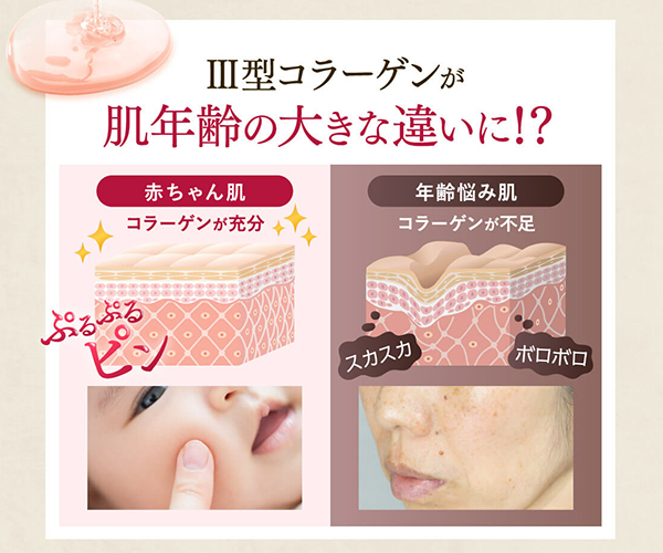 ラントゥルース Ⅲ型コラーゲン